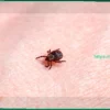 Россияне массово страдают от укусов клещей